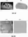 Fig. 08 - Biopsy device for coherent Raman imaging