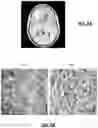 Fig. 10 - Biopsy device for coherent Raman imaging
