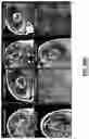 Fig. 31 - Biopsy device for coherent Raman imaging