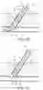 Fig. 11 - Apparatus and methods for sealing a vascular puncture