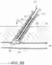 Fig. 12 - Apparatus and methods for sealing a vascular puncture