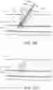 Fig. 14 - Apparatus and methods for sealing a vascular puncture