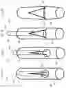 Fig. 04 - Medical apparatus and method for closing an opening in a tissue