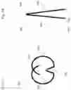 Fig. 07 - Medical apparatus and method for closing an opening in a tissue