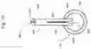 Fig. 11 - Medical apparatus and method for closing an opening in a tissue