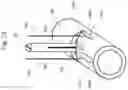 Fig. 24 - Medical apparatus and method for closing an opening in a tissue