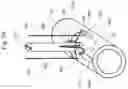 Fig. 25 - Medical apparatus and method for closing an opening in a tissue