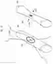 Fig. 29 - Medical apparatus and method for closing an opening in a tissue
