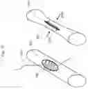 Fig. 30 - Medical apparatus and method for closing an opening in a tissue