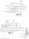 Fig. 05 - Apparatus and method for retracting brain tissue during brain surgery