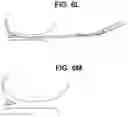 Fig. 10 - Meniscus repair