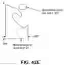 Fig. 53 - Meniscus repair