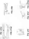 Fig. 59 - Meniscus repair