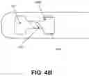 Fig. 64 - Meniscus repair