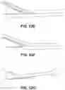 Fig. 70 - Meniscus repair