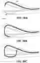 Fig. 75 - Meniscus repair