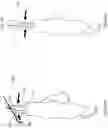 Fig. 08 - MEDICAL DEVICE WITH GRASPING MECHANISM