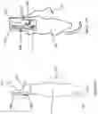 Fig. 15 - MEDICAL DEVICE WITH GRASPING MECHANISM
