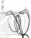 Fig. 09 - DEVICES FOR CONTINUOUS SURGICAL SUTURING