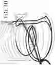 Fig. 12 - DEVICES FOR CONTINUOUS SURGICAL SUTURING