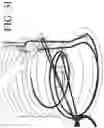 Fig. 13 - DEVICES FOR CONTINUOUS SURGICAL SUTURING