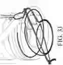 Fig. 14 - DEVICES FOR CONTINUOUS SURGICAL SUTURING