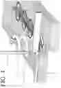 Fig. 15 - DEVICES FOR CONTINUOUS SURGICAL SUTURING