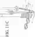 Fig. 27 - DEVICES FOR CONTINUOUS SURGICAL SUTURING