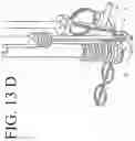 Fig. 28 - DEVICES FOR CONTINUOUS SURGICAL SUTURING