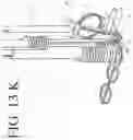 Fig. 35 - DEVICES FOR CONTINUOUS SURGICAL SUTURING