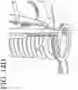 Fig. 39 - DEVICES FOR CONTINUOUS SURGICAL SUTURING