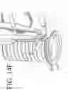 Fig. 41 - DEVICES FOR CONTINUOUS SURGICAL SUTURING
