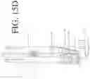 Fig. 50 - DEVICES FOR CONTINUOUS SURGICAL SUTURING