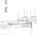 Fig. 56 - DEVICES FOR CONTINUOUS SURGICAL SUTURING