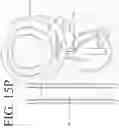 Fig. 62 - DEVICES FOR CONTINUOUS SURGICAL SUTURING