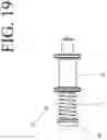 Fig. 74 - DEVICES FOR CONTINUOUS SURGICAL SUTURING