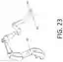 Fig. 84 - DEVICES FOR CONTINUOUS SURGICAL SUTURING