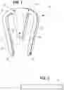 Fig. 02 - Orthopedic implant, method, and kit