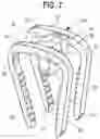 Fig. 05 - Orthopedic implant, method, and kit