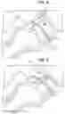 Fig. 06 - Orthopedic implant, method, and kit