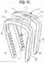Fig. 08 - Orthopedic implant, method, and kit