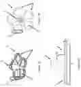 Fig. 04 - Systems and methods for delivering an implantable device