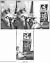 Fig. 06 - A COLLAPSIBLE AND ADJUSTABLE VESSEL TREATMENT DEVICE AND ADVANCED CUFF WITH INDEPENDENT AND DYNAMICALLY CONTROLLED CHARGE AND DISCHARGE MODES FOR A VESSEL OR SAC WALL TREATMENT AND A CARDIAC ASSIST DEVICE