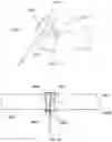 Fig. 15 - A COLLAPSIBLE AND ADJUSTABLE VESSEL TREATMENT DEVICE AND ADVANCED CUFF WITH INDEPENDENT AND DYNAMICALLY CONTROLLED CHARGE AND DISCHARGE MODES FOR A VESSEL OR SAC WALL TREATMENT AND A CARDIAC ASSIST DEVICE