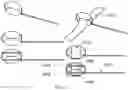 Fig. 25 - A COLLAPSIBLE AND ADJUSTABLE VESSEL TREATMENT DEVICE AND ADVANCED CUFF WITH INDEPENDENT AND DYNAMICALLY CONTROLLED CHARGE AND DISCHARGE MODES FOR A VESSEL OR SAC WALL TREATMENT AND A CARDIAC ASSIST DEVICE