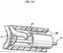 Fig. 08 - Aneurysm method and system