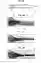 Fig. 10 - Aneurysm method and system