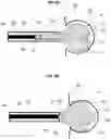 Fig. 05 - ANEURYSM DEVICE AND DELIVERY SYSTEM