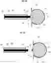 Fig. 06 - ANEURYSM DEVICE AND DELIVERY SYSTEM