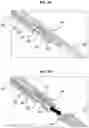 Fig. 08 - ANEURYSM DEVICE AND DELIVERY SYSTEM